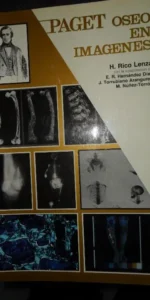 Paget óseo en imágenes, H. Rico Lenza, ed. Jarpyo
