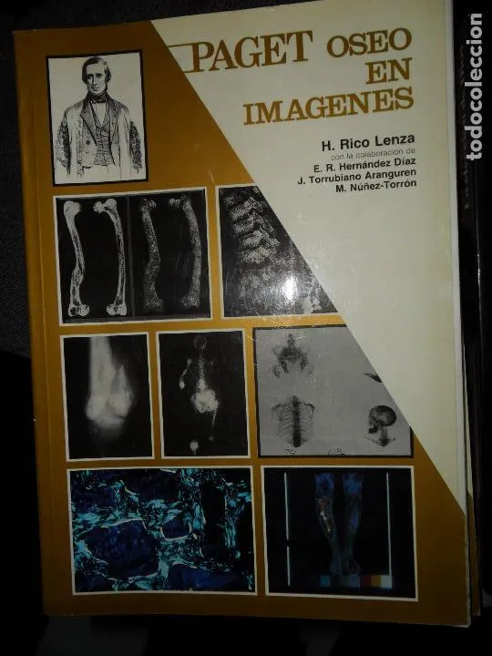 Paget óseo en imágenes, H. Rico Lenza, ed. Jarpyo Paget óseo en imágenes, H. Rico Lenza, ed. Jarpyo