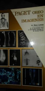 Paget óseo en imágenes, H. Rico Lenza, ed. Jarpyo