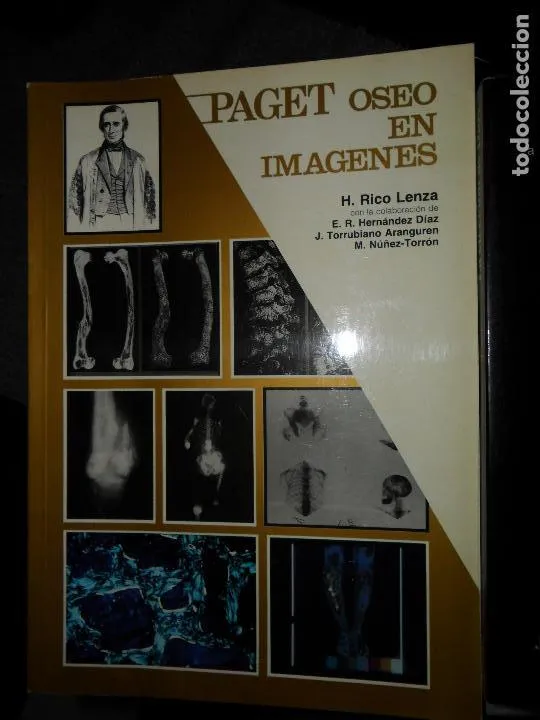 Paget óseo en imágenes, H. Rico Lenza, ed. Jarpyo Paget óseo en imágenes, H. Rico Lenza, ed. Jarpyo