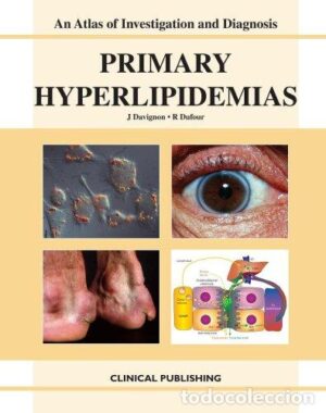 Primary Hyperlipidemias (Hiperlipidemias Primarias)